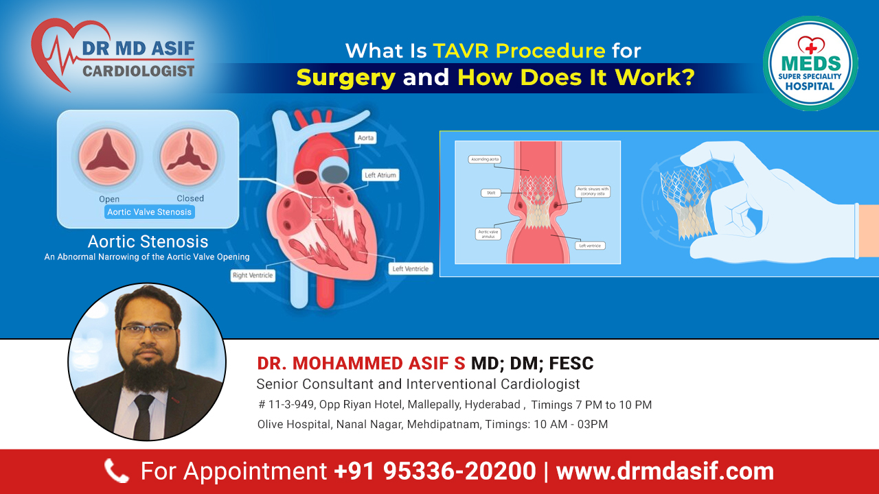 What Is TAVR Procedure for Surgery and How Does It Work?