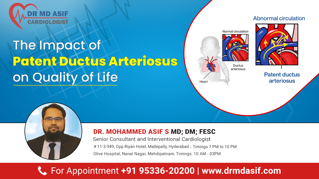 The Impact of Patent Ductus Arteriosus on Quality of Life| Dr Asif